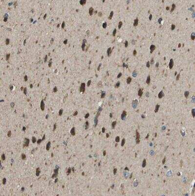 Immunohistochemistry-Paraffin: SEC62 Antibody [NBP1-84045]