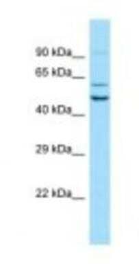 Western Blot: SEC62 Antibody [NBP1-98450]