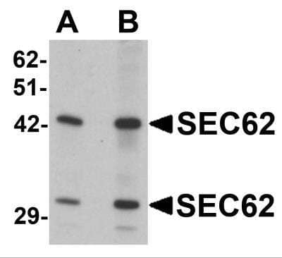 Western Blot: SEC62 AntibodyBSA Free [NBP2-81813]