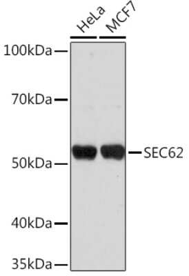 Western Blot: SEC62 AntibodyAzide and BSA Free [NBP3-15573]