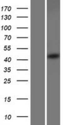 Western Blot: SEC62 Overexpression Lysate [NBP2-08026]