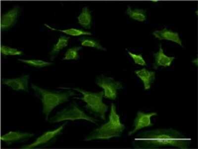 Immunocytochemistry/ Immunofluorescence: SEC63 Antibody (1A8) [H00011231-M04]