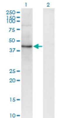 Western Blot: SEC63 Antibody (1A8) [H00011231-M04]