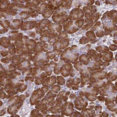 Immunohistochemistry-Paraffin: SEC63 Antibody [NBP2-30405]