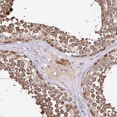 Immunohistochemistry-Paraffin: SEC63 Antibody [NBP2-30405]
