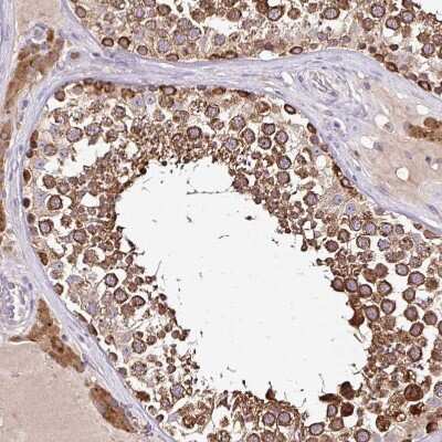 Immunohistochemistry-Paraffin: SEC63 Antibody [NBP2-30405]