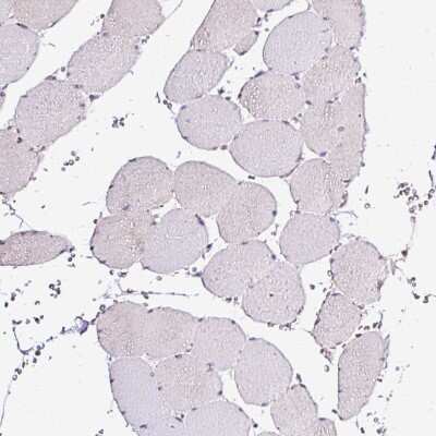 Immunohistochemistry-Paraffin: SEC63 Antibody [NBP2-30405]
