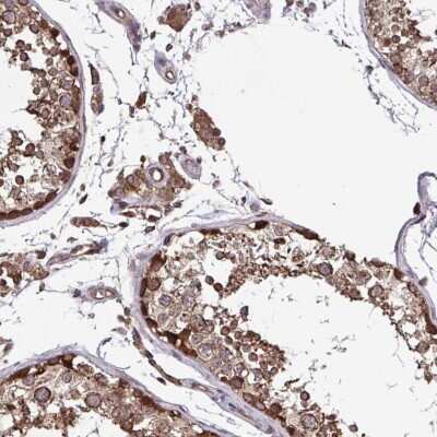 Immunohistochemistry-Paraffin: SEC63 Antibody [NBP2-38893]