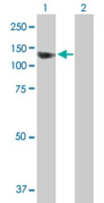 Western Blot: SEC63 Antibody [H00011231-B01P]