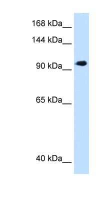 Western Blot: SEC63 Antibody [NBP1-59694]