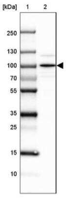 Western Blot: SEC63 Antibody [NBP2-30405]