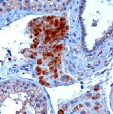 Immunohistochemistry-Paraffin: SECISBP2 Antibody [NB100-53795]