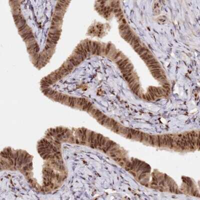 Immunohistochemistry-Paraffin: SECISBP2 Antibody [NBP1-92375]