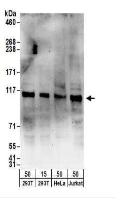 Western Blot: SECISBP2 Antibody [NBP2-22301]