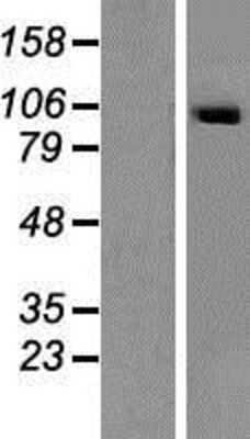 Western Blot: SECISBP2 Overexpression Lysate [NBP2-06344]