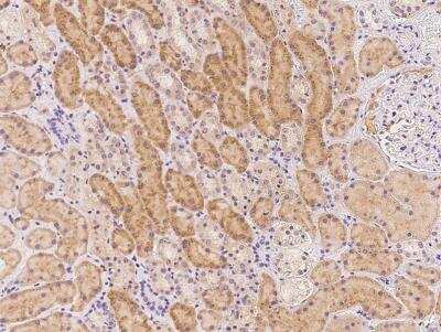 Immunohistochemistry-Paraffin: SECISBP2L Antibody [NBP3-05914]