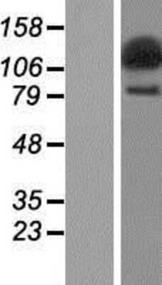 Western Blot: SECISBP2L Overexpression Lysate [NBP2-07286]