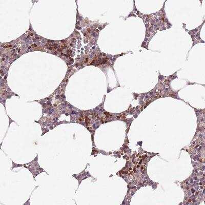 Immunohistochemistry-Paraffin: SECTM1 Antibody [NBP2-13292]