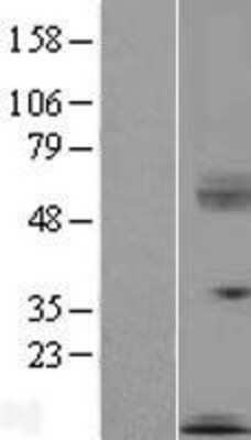 Western Blot: SECTM1 Overexpression Lysate [NBP2-08051]