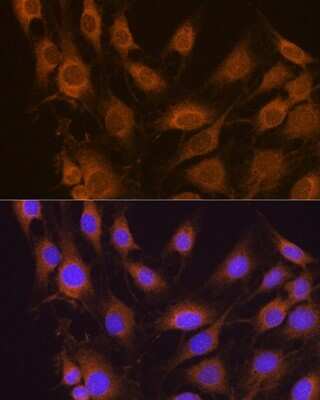 Immunocytochemistry/ Immunofluorescence: SEL1L Antibody - Azide and BSA Free [NBP2-93746]