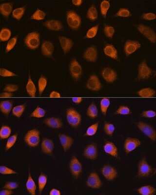 Immunocytochemistry/ Immunofluorescence: SEL1L Antibody - Azide and BSA Free [NBP2-93746]