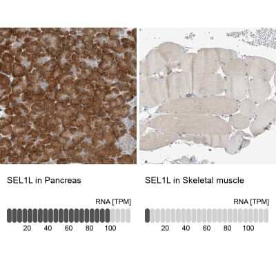 Immunohistochemistry-Paraffin: SEL1L Antibody [NBP1-81623]