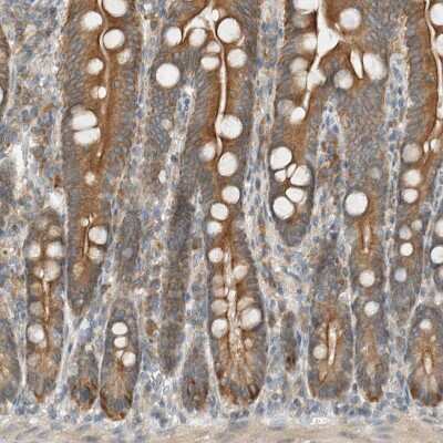 Immunohistochemistry-Paraffin: SEL1L Antibody [NBP1-81623]