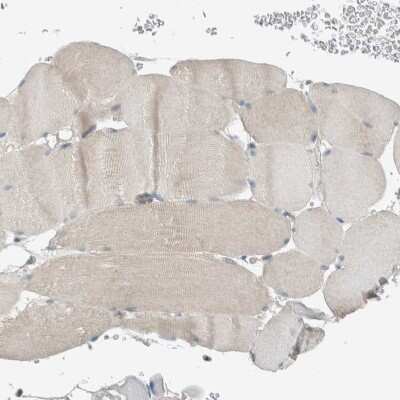 Immunohistochemistry-Paraffin: SEL1L Antibody [NBP1-81623]