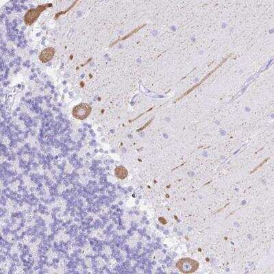 Immunohistochemistry-Paraffin: SEL1L2 Antibody [NBP2-32426]