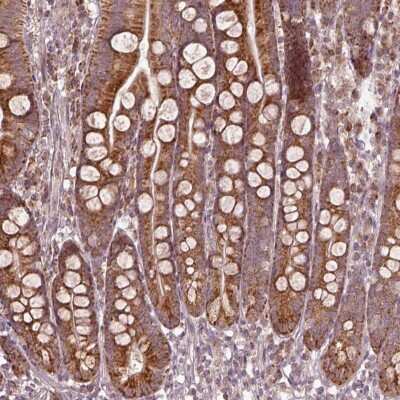 Immunohistochemistry-Paraffin: SEL1L3 Antibody [NBP2-58051]
