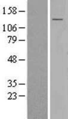 Western Blot: SEL1L3 Overexpression Lysate [NBL1-12254]