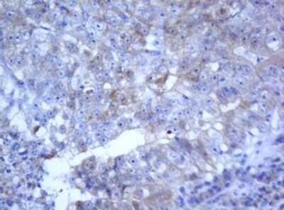Immunohistochemistry: SELENBP1 Antibody (OTI3H1) [NBP2-45979]