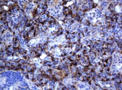 Immunohistochemistry: SELENBP1 Antibody (OTI3H1) [NBP2-45979]