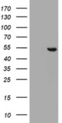 Western Blot: SELENBP1 Antibody (OTI3H1) [NBP2-45979]