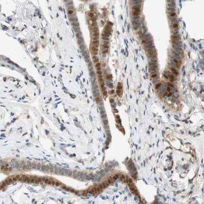 Immunohistochemistry: SELENBP1 Antibody [NBP1-83196]
