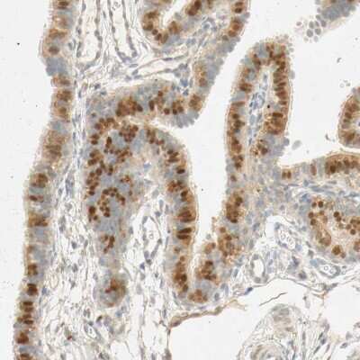 Immunohistochemistry: SELENBP1 Antibody [NBP1-83197]