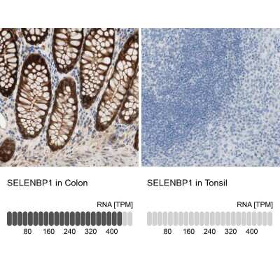 Immunohistochemistry-Paraffin: SELENBP1 Antibody [NBP1-83196]