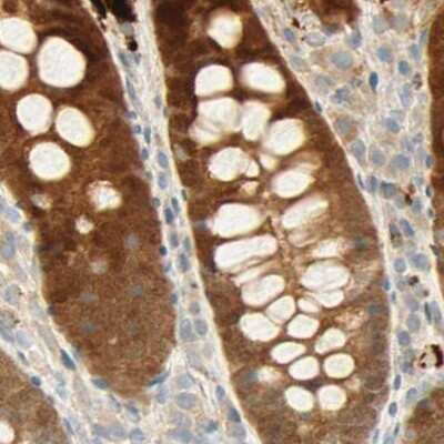 Immunohistochemistry-Paraffin: SELENBP1 Antibody [NBP1-83197]