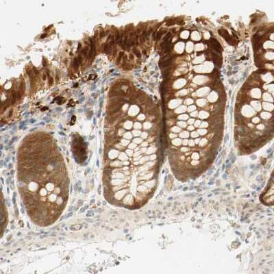 Immunohistochemistry-Paraffin: SELENBP1 Antibody [NBP1-83197]