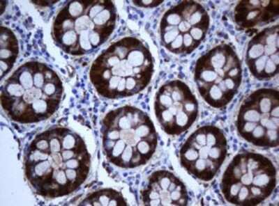 Immunohistochemistry: SELENBP1 Antibody (OTI3H1) - Azide and BSA Free [NBP2-74053]