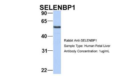 Western Blot: SELENBP1 Antibody [NBP1-55263]