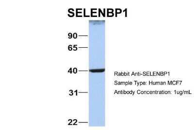 Western Blot: SELENBP1 Antibody [NBP1-55263]