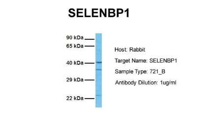 Western Blot: SELENBP1 Antibody [NBP1-55263]
