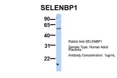 Western Blot: SELENBP1 Antibody [NBP1-55263]