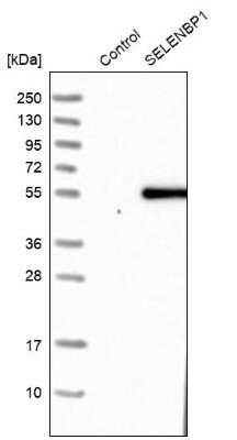 Western Blot: SELENBP1 Antibody [NBP1-83197]