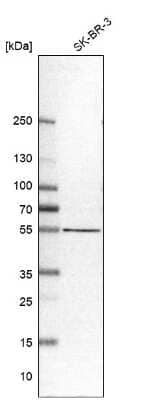 Western Blot: SELENBP1 Antibody [NBP1-83197]