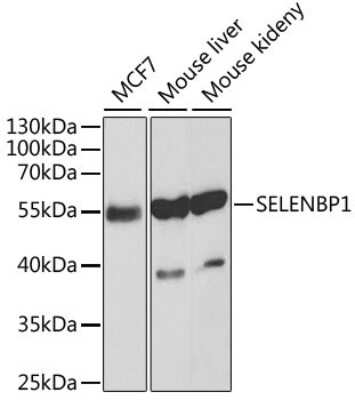 Western Blot: SELENBP1 AntibodyBSA Free [NBP3-03603]