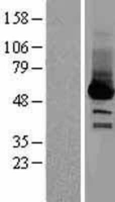 Western Blot: SELENBP1 Overexpression Lysate [NBL1-15791]