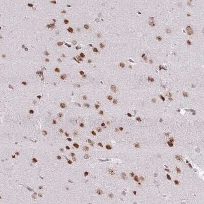 Immunohistochemistry-Paraffin: SELH Antibody [NBP2-14637]