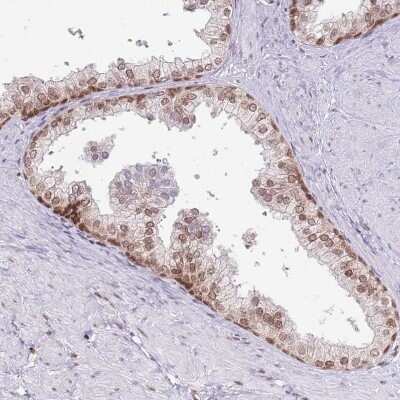 Immunohistochemistry-Paraffin: SELH Antibody [NBP2-14637]
